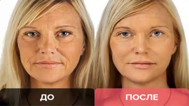 Лифтинг маска Cledbel смотреть онлайн