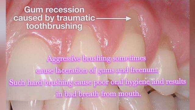 BUSTING THE MYTH - THE HARDER YOU BRUSH MORE WHITE AND SHINNER TEETH YOU WILL GET ?????