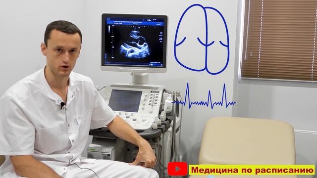Мерцательная аритмия, фибрилляция предсердий (её диагностика) смотреть онлайн