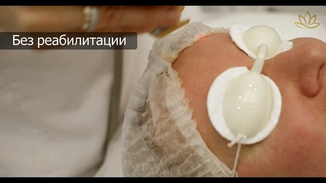 Лазерное омоложение Cutera Genesis смотреть онлайн