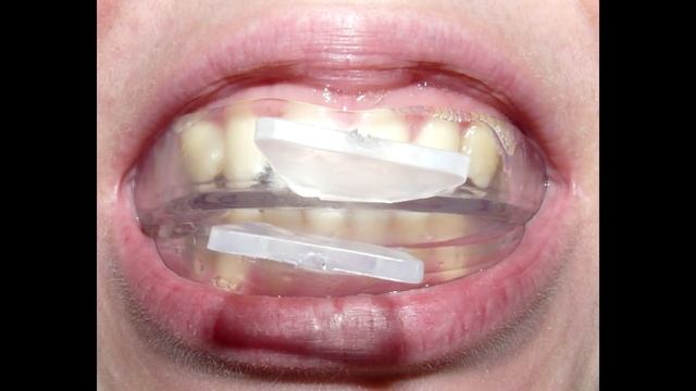 Скрежет зубов смотреть онлайн