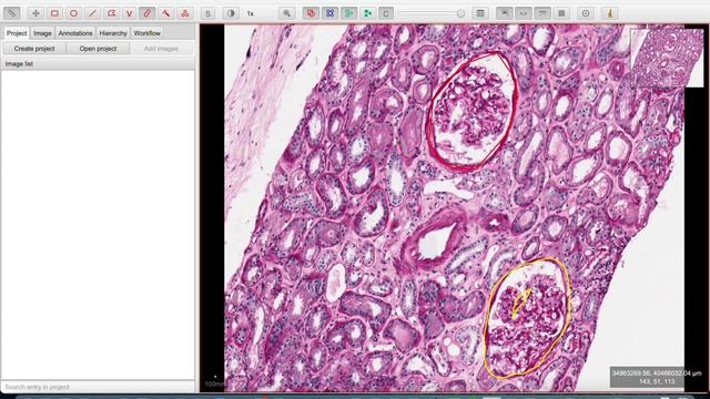 Biomedical labeling using QuPath with JSON output смотреть онлайн