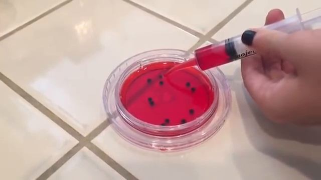 Robert Koch Microbiology Project