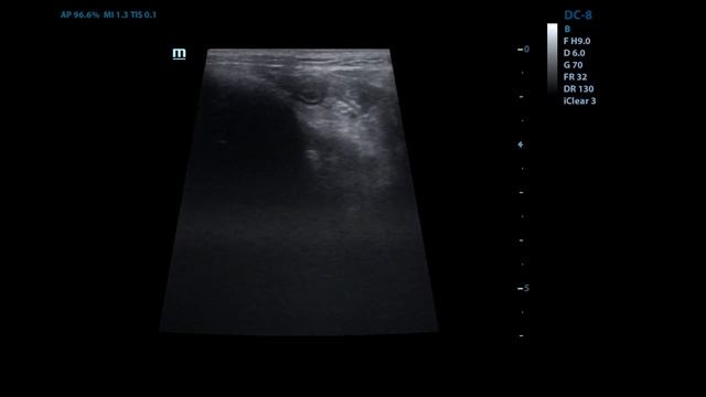 дивертикул кишки у собак bowel diverticula in dogs смотреть онлайн
