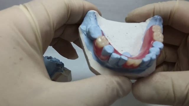 Частично съёмный нейлоновый протез смотреть онлайн