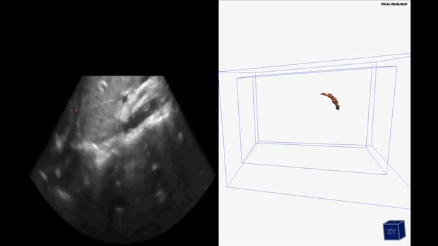 High-Quality 3D Visualization of In-Situ Ultrasonography смотреть онлайн