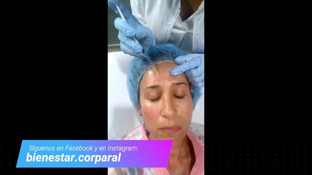 Mesoterapia Facial Con Dmae. CLINICA BIENESTAR CORPORAL