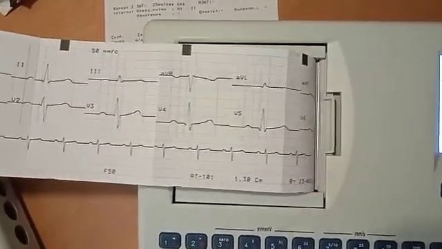 Электрокардиограф Шиллер АТ 101 смотреть онлайн