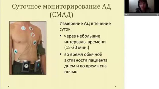 Гипертоническая болезнь Подходы к коррекции парафармацевтиками линейки Диэнай смотреть онлайн