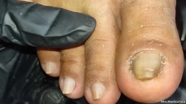 Vlog 983|Dry Skin/Ingrown Removal| PEDICURE 883 смотреть онлайн