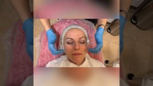 Голливудский пилинг BioRePeel. Взгляд изнутри.