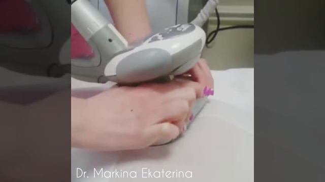 LPG массаж смотреть онлайн