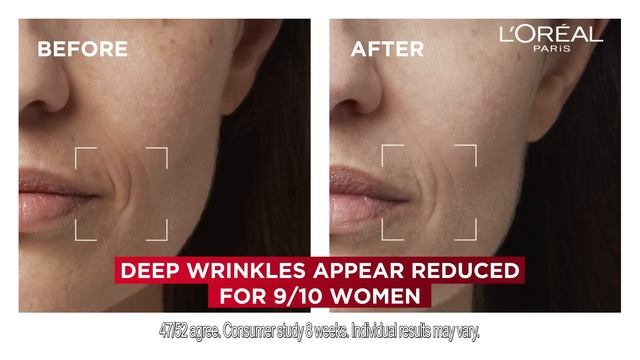 Revitalift Laser Claim смотреть онлайн
