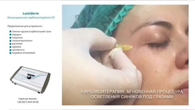 Lumiderm. Инъекционная карбокситерапия CO2 смотреть онлайн