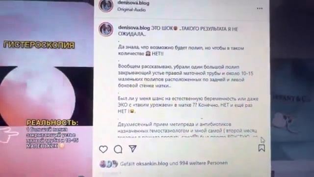‼️ГИСТЕРОСКОПИЯ И ‼️ПЛАНИРОВАНИЕ смотреть онлайн