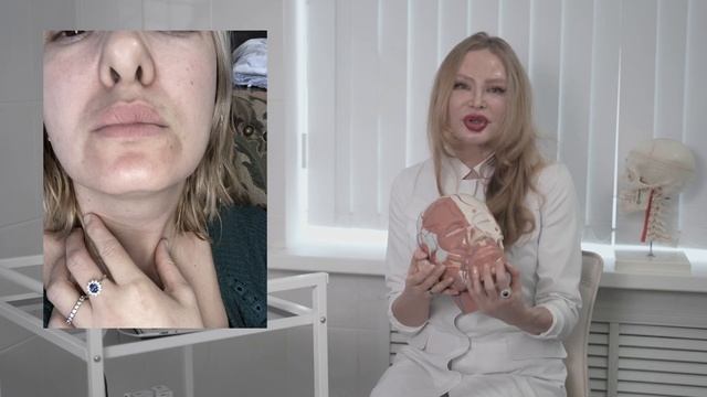 Как вернуть губы, которые были до введения филлера? смотреть онлайн