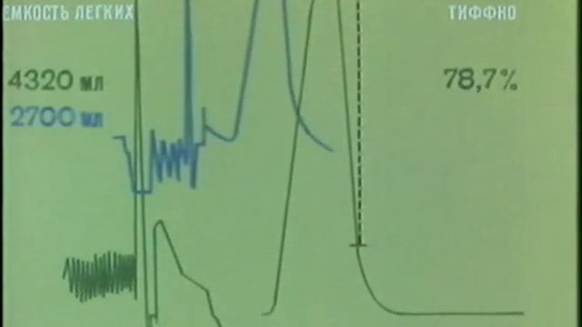 Бронхиальная астма / Bronchiales Asthma смотреть онлайн