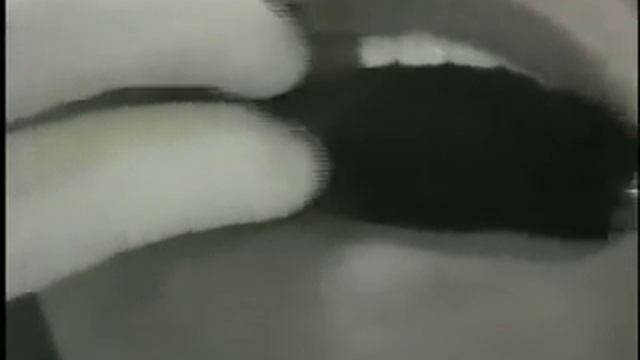 нейлоновые протезы смотреть онлайн
