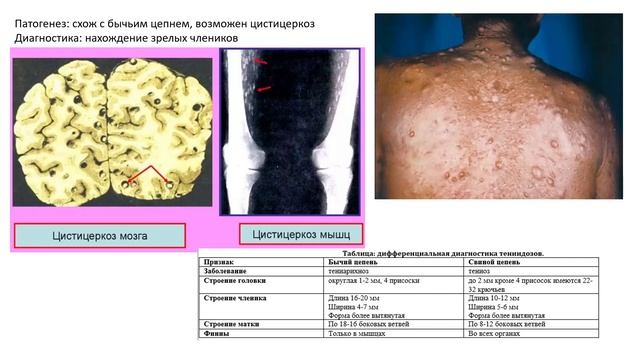 Экзамен по биологии | ЛЕНТОЧНЫЕ ЧЕРВИ. Бычий цепень. Свиной цепень. Широкий лентец смотреть онлайн