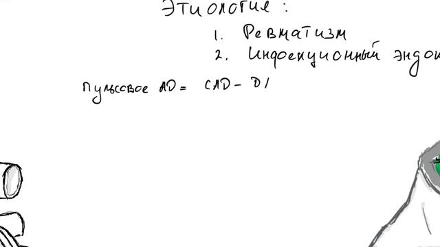 Недостаточность аортального клапана. смотреть онлайн