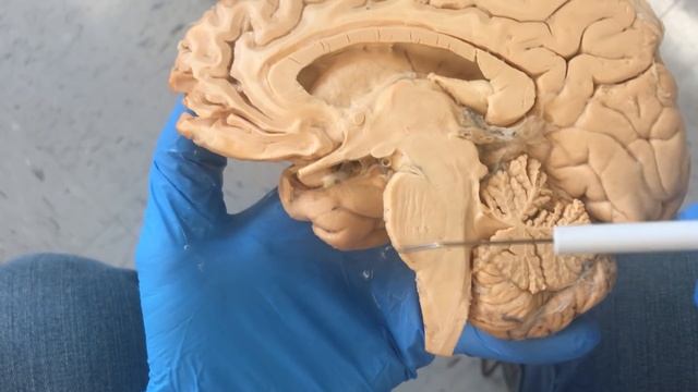 The Anatomy Of A Lobotomy