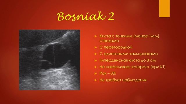УЗ-диагностика кист почек (подробно). УЗИ в урологии-2020 (минисерии) Станислав Феданов смотреть онлайн