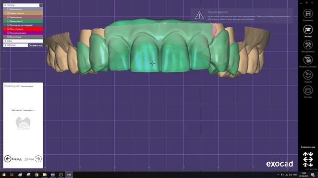 Моделирование (повторение) готовой восковой конструкции exocad смотреть онлайн