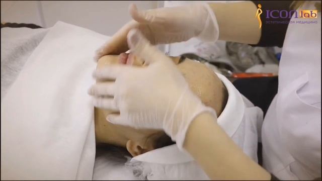 Миндальный пилинг смотреть онлайн
