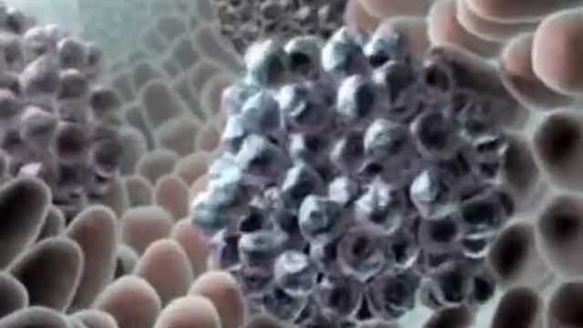Гливек при опухолях, Механизм действия Гливек смотреть онлайн