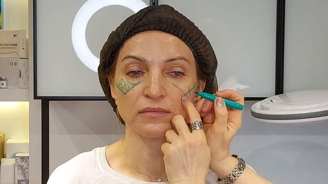 1.04 ГА.Разметка. смотреть онлайн