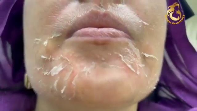 Yuzilarda Dog Bolsa Shu Videoni Koring Мафтуна Касматолог