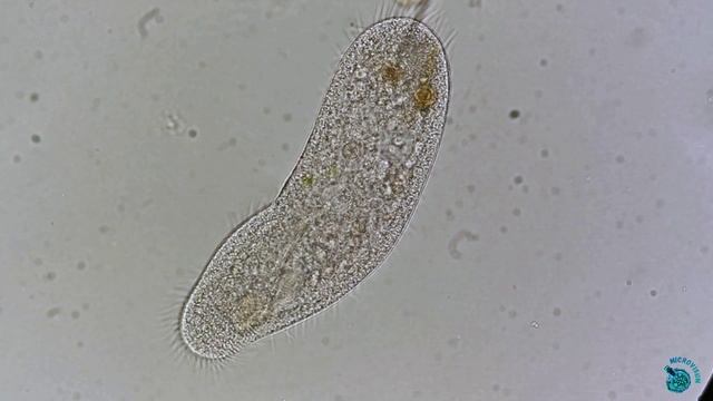 Инфузория Anteholosticha смотреть онлайн