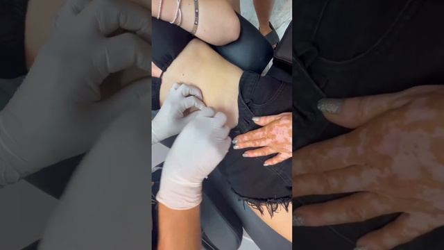 THIS WAS THE WORST PAIN OF MY LIFE 😬😬😪 смотреть онлайн