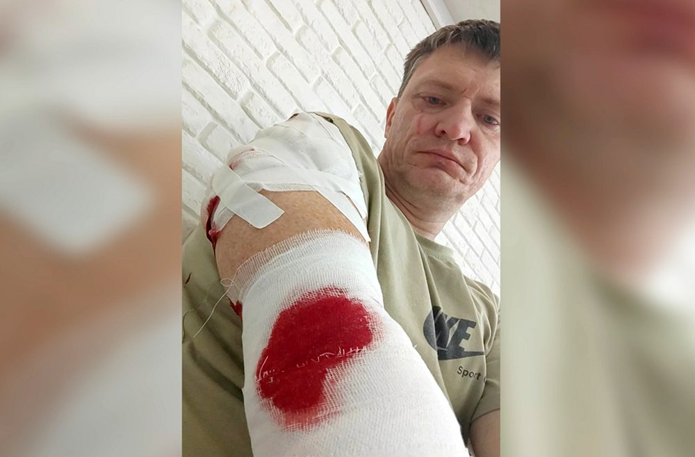 Огромный алабай напал на мужчину в Башкирии / События на ТВЦ смотреть онлайн