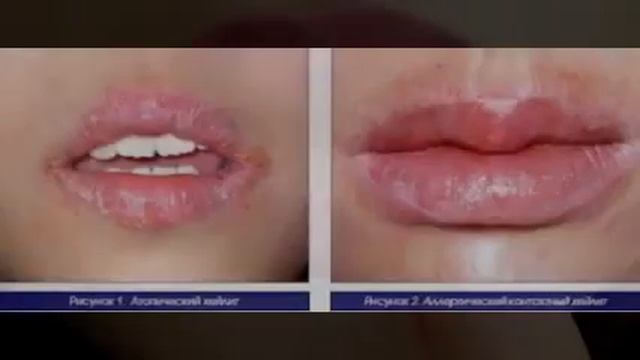 Хейлит смотреть онлайн