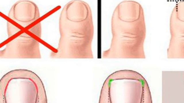 Как правильно подстригать ногти смотреть онлайн