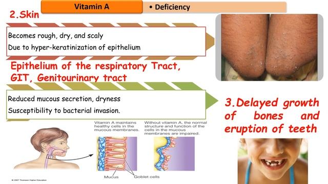 MED.LEVEL 2. GIT module. BIO Lecture 6 Vitamins (part1) смотреть онлайн