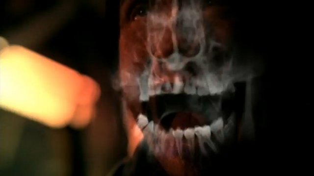 Переломы костей!!! ЖЖЖЖЖжжесть!!! смотреть онлайн