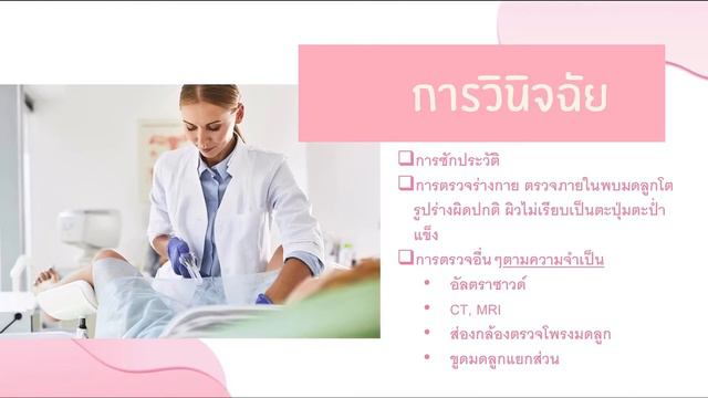 Myoma uteri-advice смотреть онлайн