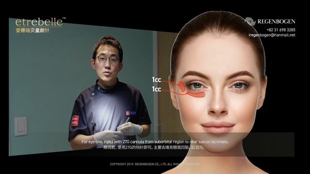 [ ETREBELLE ] Filler 【爱得瑞贝】童颜针/ Live Seminar 现场研讨会/Woon-kyung Chung, M.D. смотреть онлайн