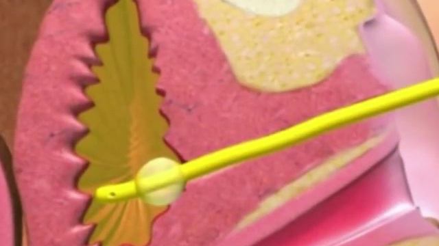 urinary_catheterization-2.mp4 смотреть онлайн