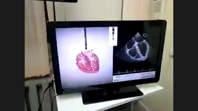 Bakulev CPBSS - Симулятор сердечно-сосудистой хирургии