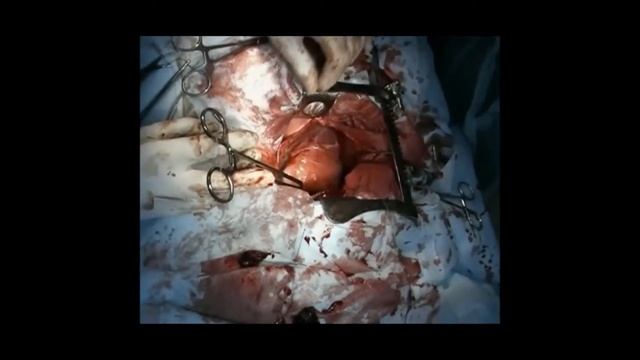 Гемангиосаркома сердца.2. Ветклиника 