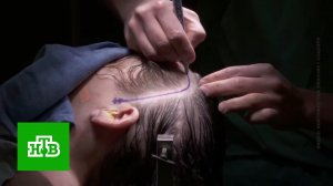 Как пожирающие мозг паразиты проникают в головы простых россиян | «ЦТ»