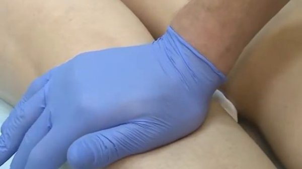 флебология в Laser Clinic