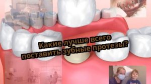 Какие лучше всего поставить зубные протезы?