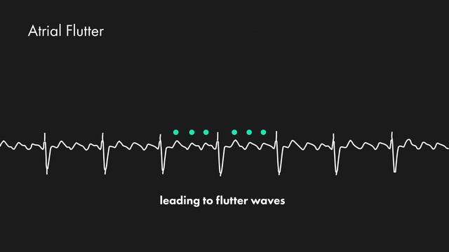 Atrial Fibrillation vs Atrial Flutter - ECG (EKG) Interpretation - MEDZCOOL смотреть онлайн
