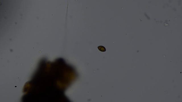 Fungal spore смотреть онлайн