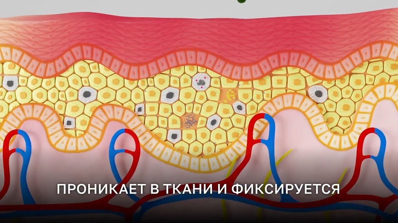 Фотодинамическая терапия REVIXAN: устраните все проблемы кожи смотреть онлайн