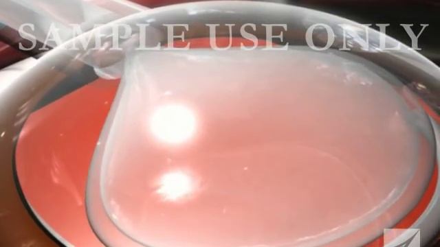 Eye Surgery- Cataract with Lens Replacement смотреть онлайн